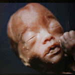 Andres Serrano The Unborn 1994.jpg