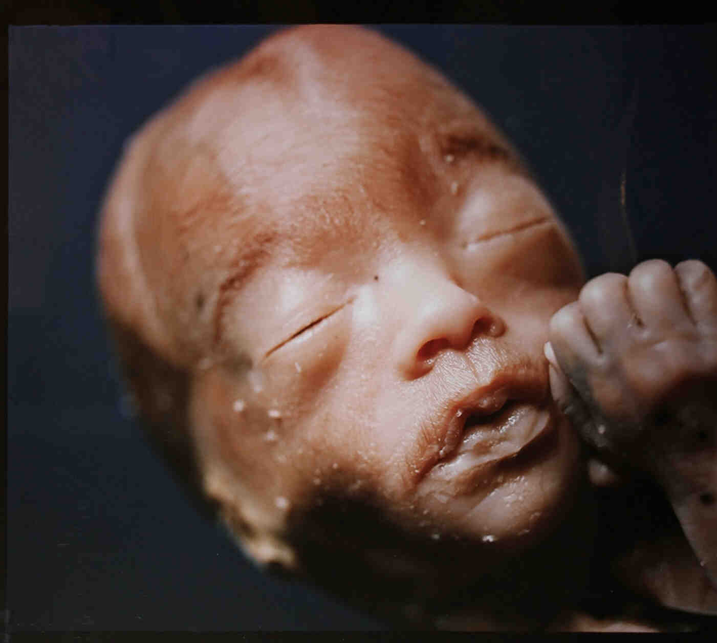 The Unborn, 1994.