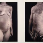 Chuck Close Doctors of the World Limited Edition Photograph